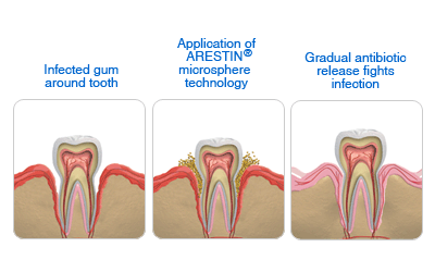 gum disease treatment honolulu